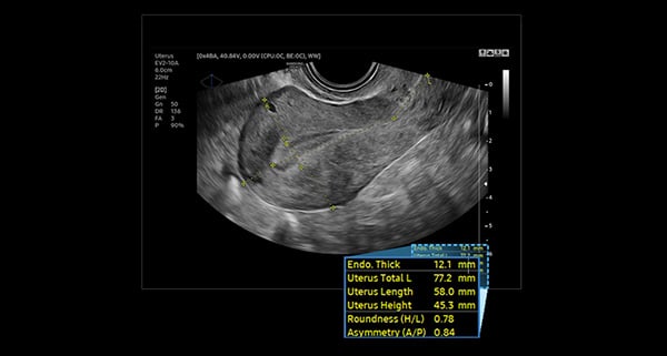 usa-samsung-wh-hs40-uterine-assist