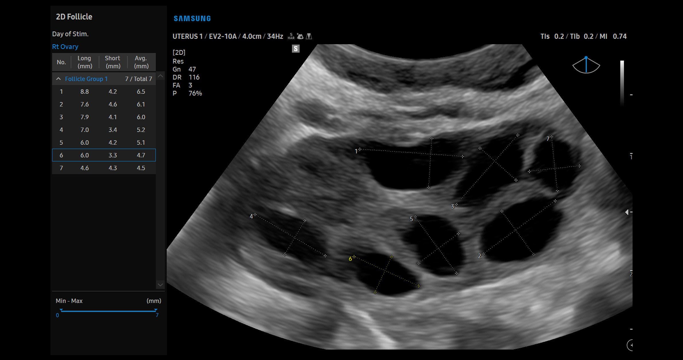 usa-samsung-wh-v5-carousel-2D-Follicle