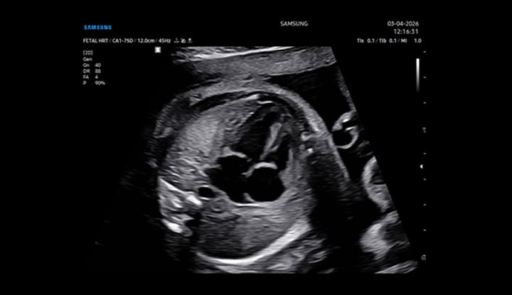 usa-samsung-wh-v5-clearvision