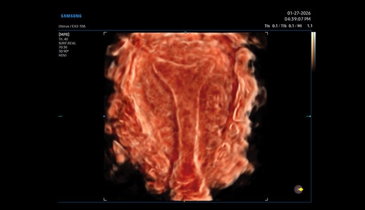 usa-samsung-wh-v5-crystalvue