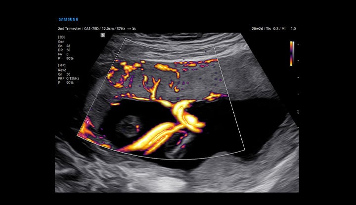 usa-samsung-wh-v5-mv-flow