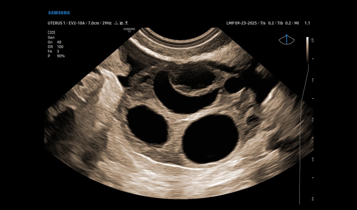 usa-samsung-wh-v5-rotator-Ovarian-Follicles-1