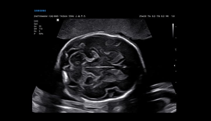 usa-samsung-wh-v5-s-vue-transducers-1