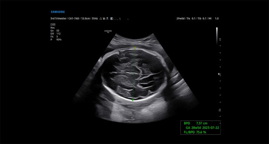 usa-samsung-wh-v6-biometry-assist