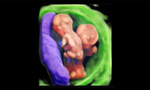 EzVolume with twins