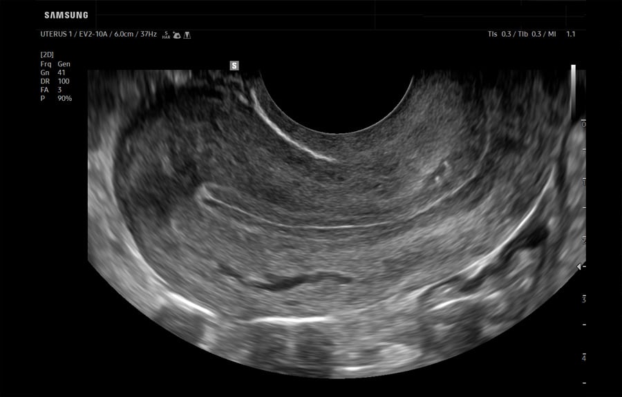 wh-q10-uterus