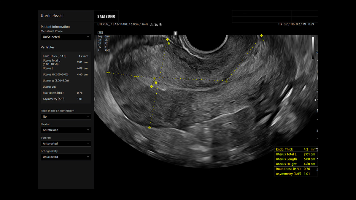 wh-v4-automation-carousel-uterine-assist