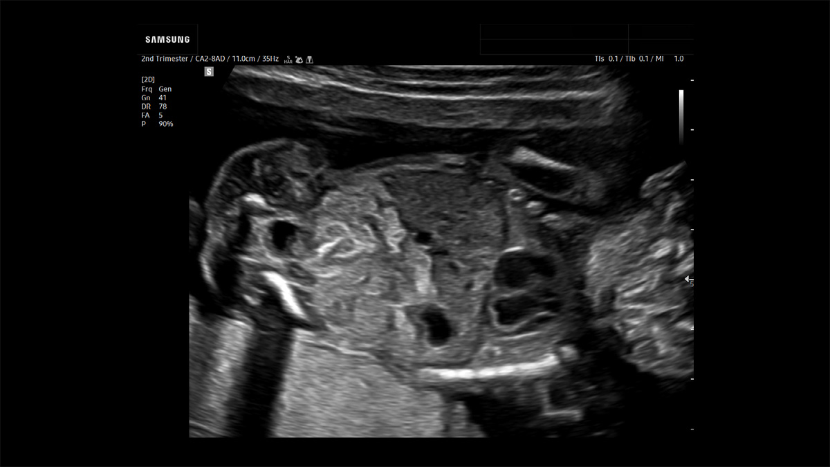 wh-v4-image-carousel-liver-lung