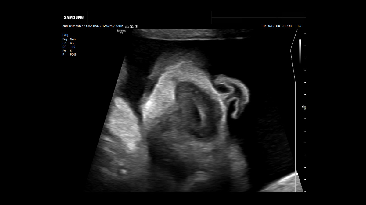 wh-v4-image-carousel-nose-lips