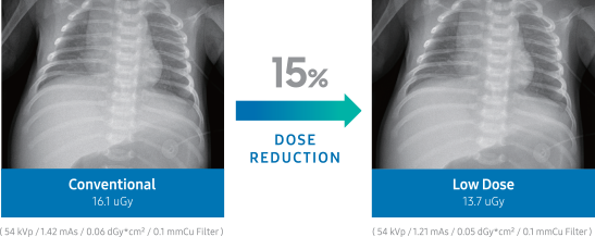 conventional pediatric chest scan