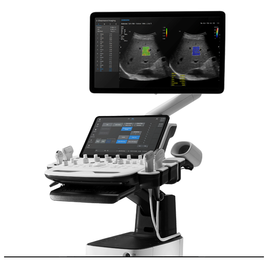 V5 Ultrasound