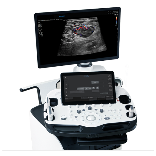 RS85 Prestige Ultrasound