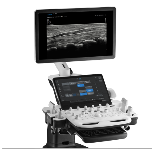 V5 Ultrasound